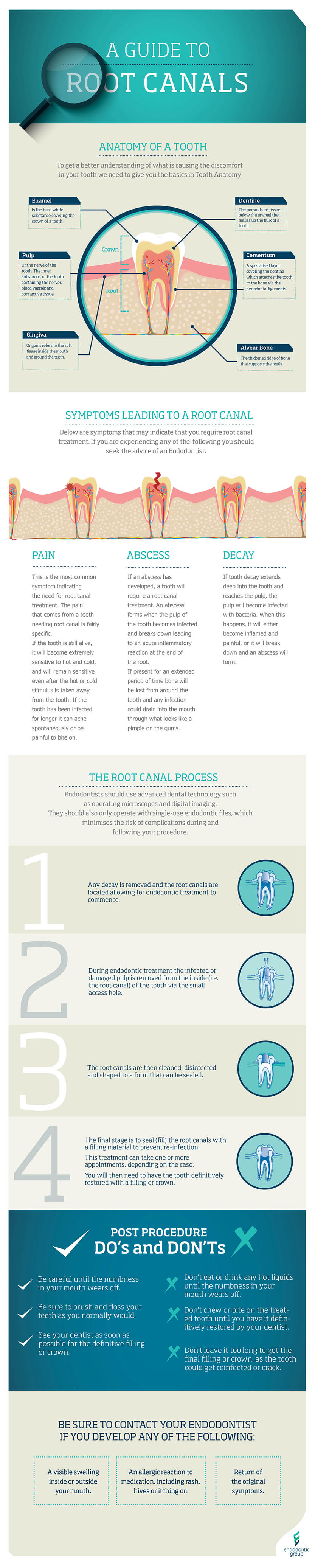 A Guide to Root Canals